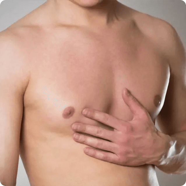 Close-up view of a man's chest before undergoing male chest enhancement, showcasing a flatter or less muscular chest that he wishes to improve. The man has a neutral expression, and the clinical setting highlights the areas of focus for the procedure aimed at achieving a fuller, more defined chest contour.