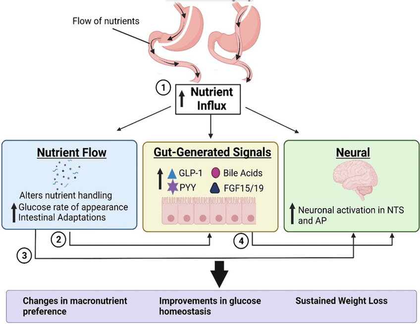 Mechanism of Bariatric Surgery | Dr Aloy Mukherjee