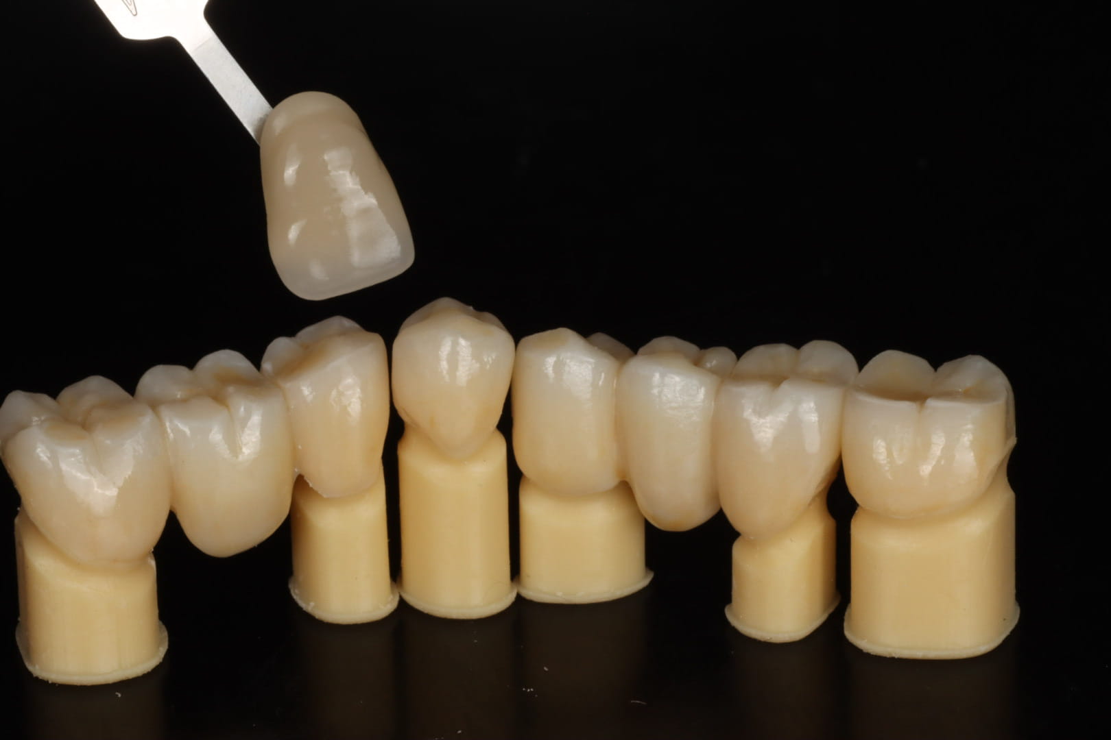 Digital dental scan and restorative prosthodontic treatment planning for crowns, bridges, and dental implants at K DentArtistry Makati.