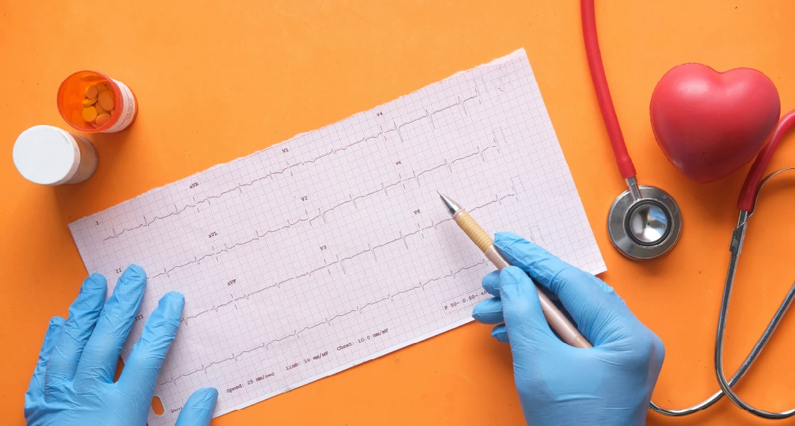 CAC Scrore Vs. Stress