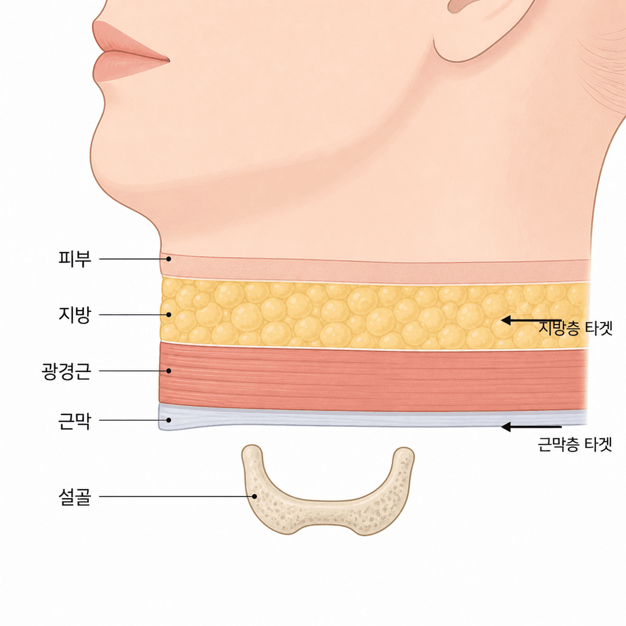 턱 아래 다섯 층 — 조여지는 층과 조여도 안 움직이는 층