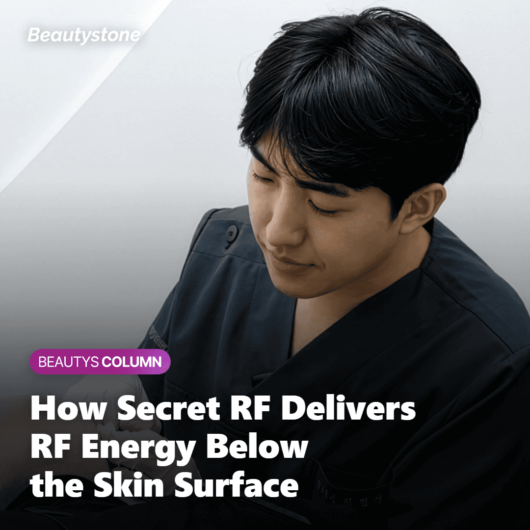 Diagram showing Secret RF microneedles delivering radiofrequency energy into the dermis layer to stimulate collagen remodeling around an acne scar