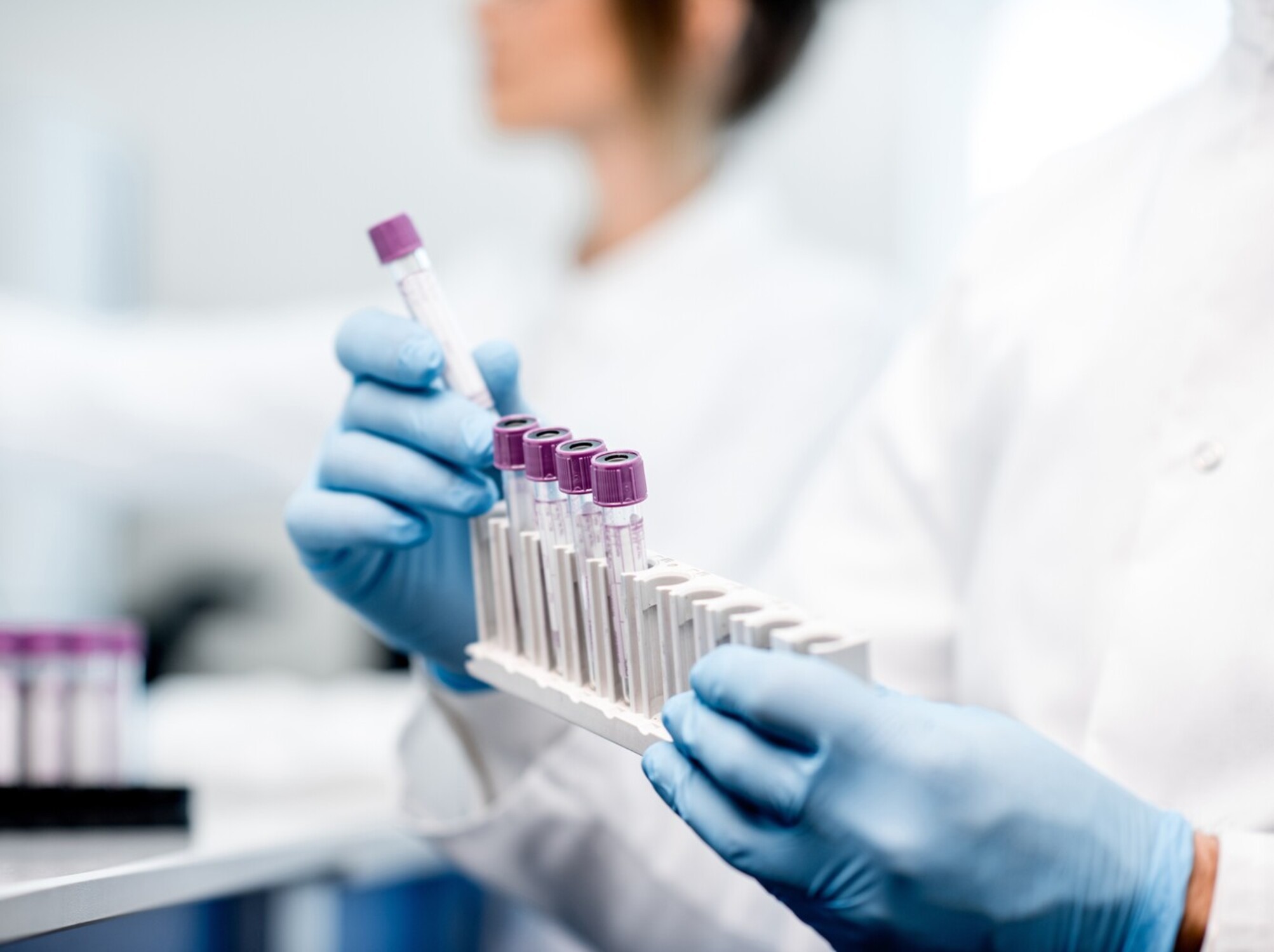 weight loss without trying