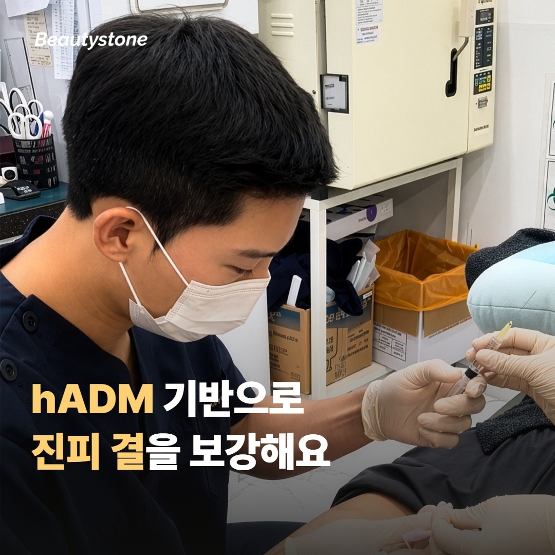 RE2O 스킨부스터는 어떻게 작용하나요?