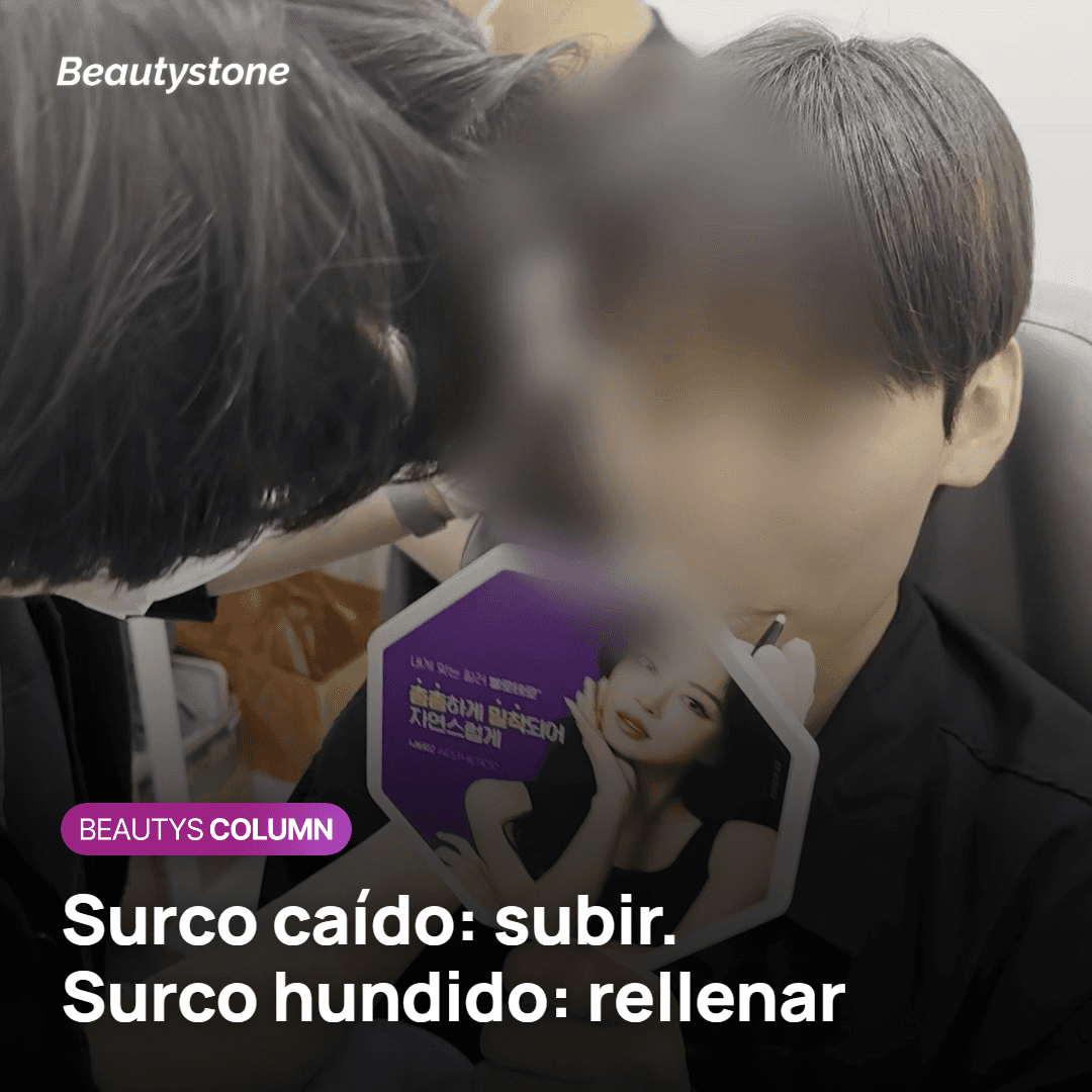 Surco caído frente a surco hundido: señales visibles y opciones por capa