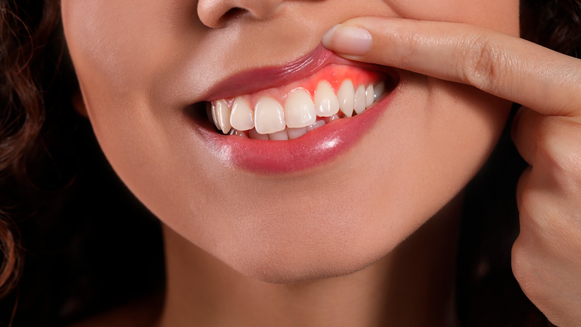 Urgências Dentárias