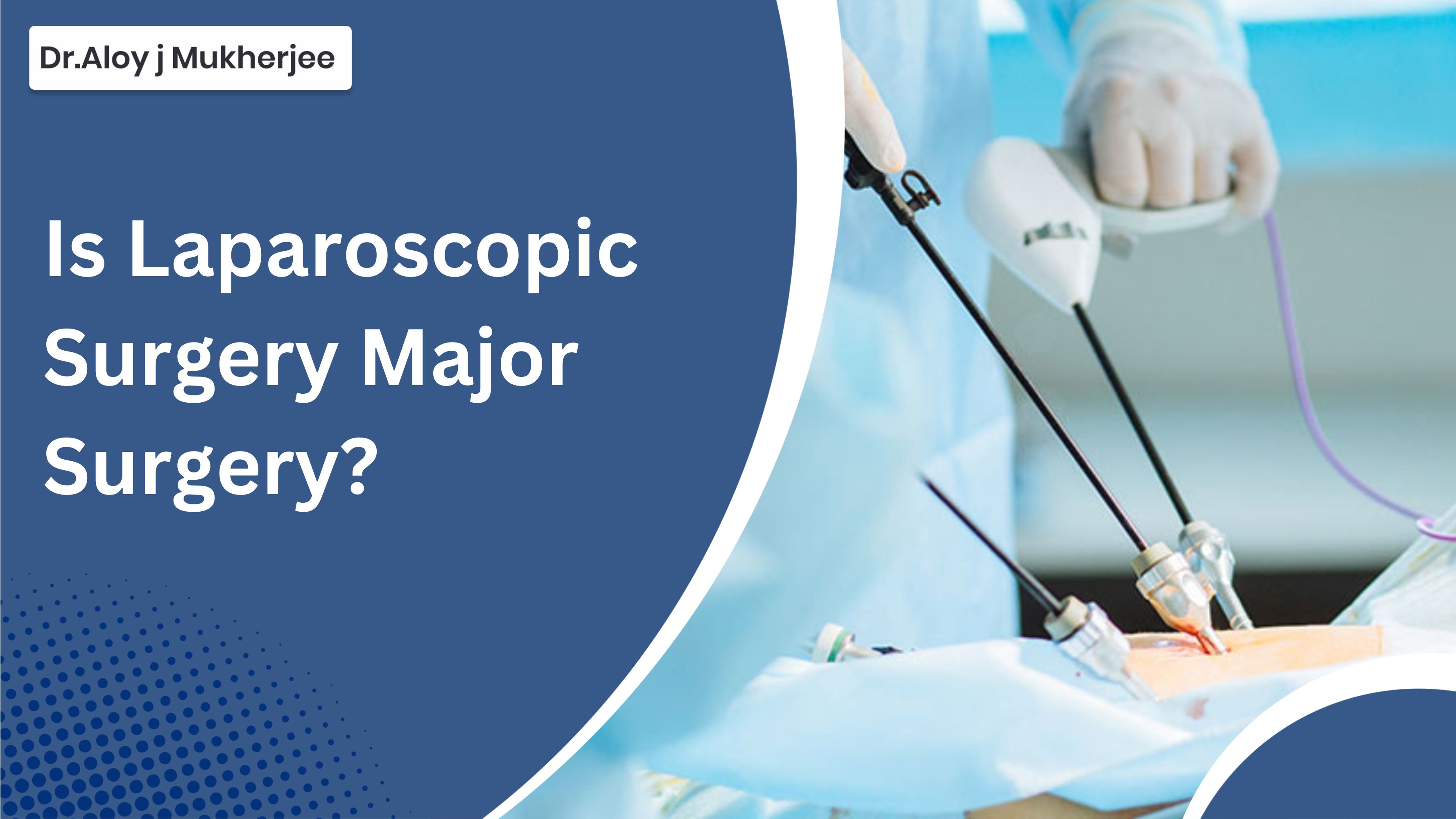 Is Laparoscopic Surgery Major Surgery