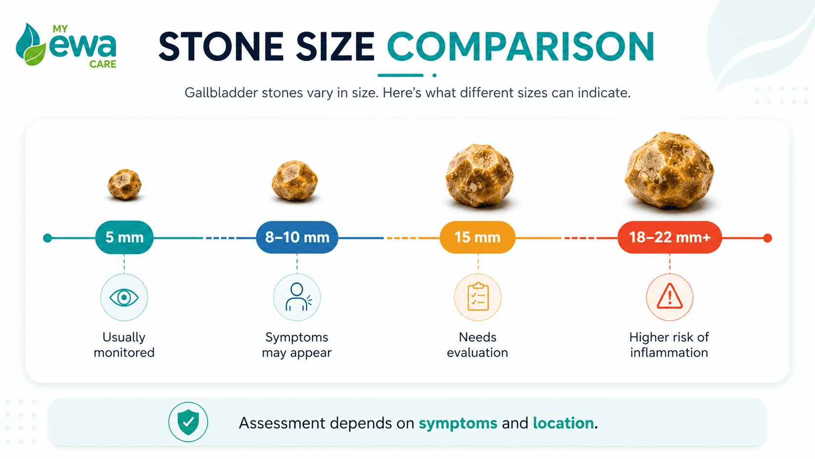 Gallbladder stone size comparison chart