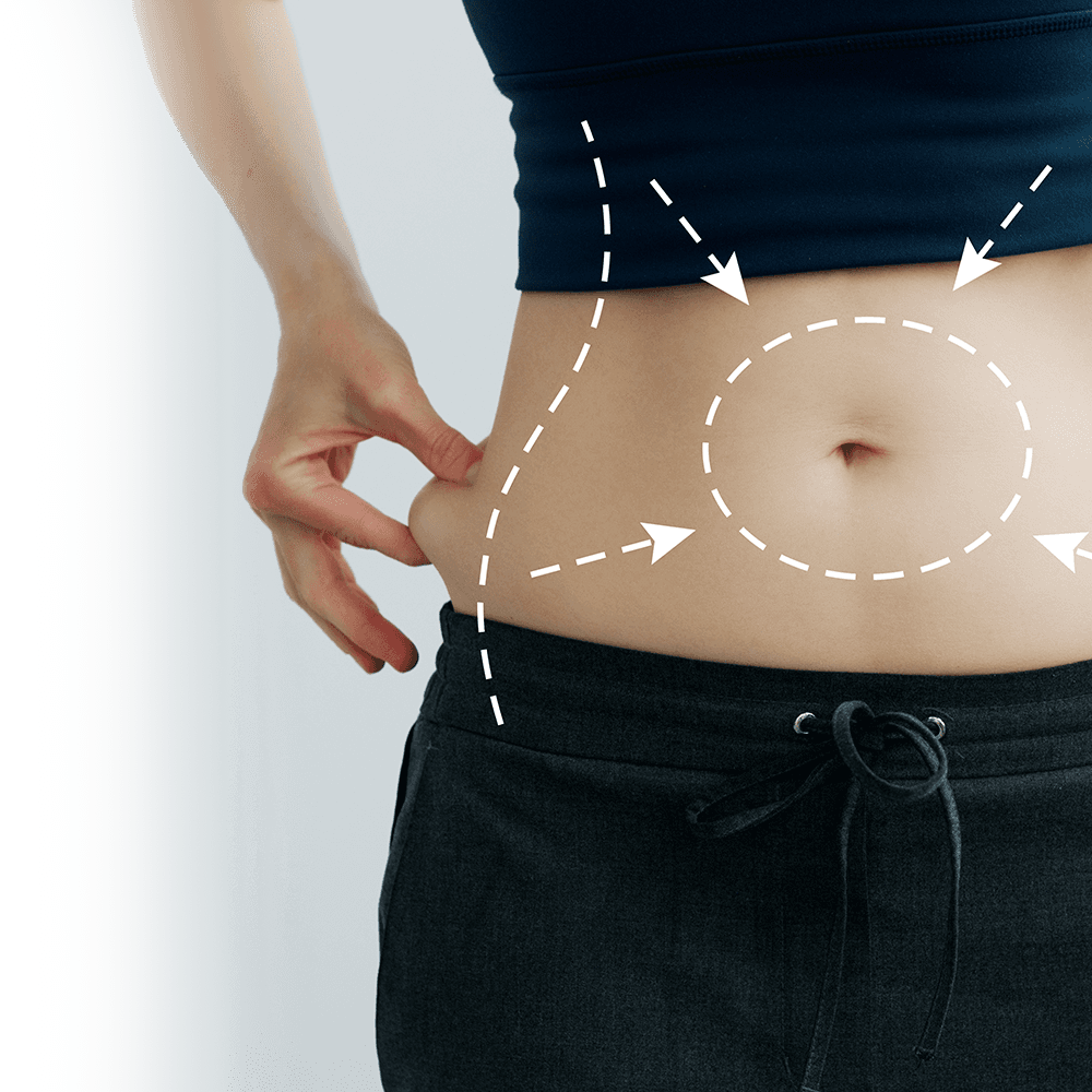 vectors of liposuction and tummy tuck surgery