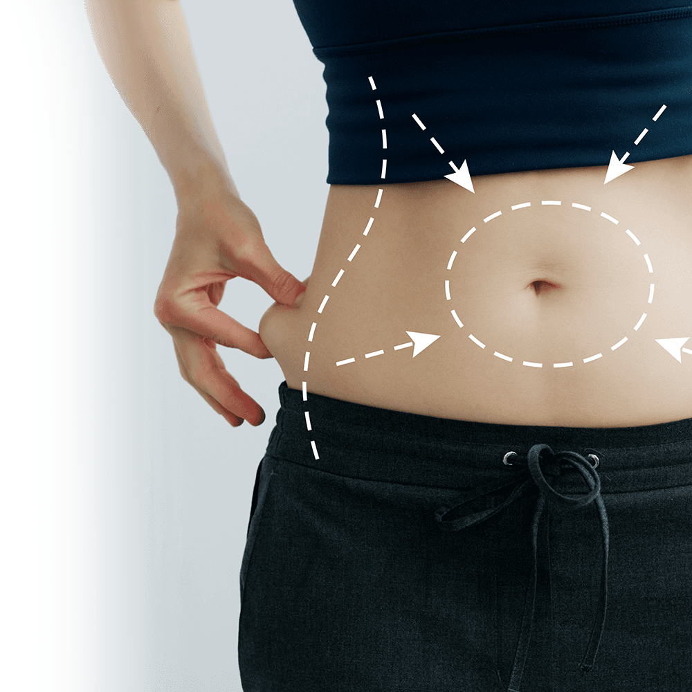 liposuction ve karın germe ameliyatı vektörleri