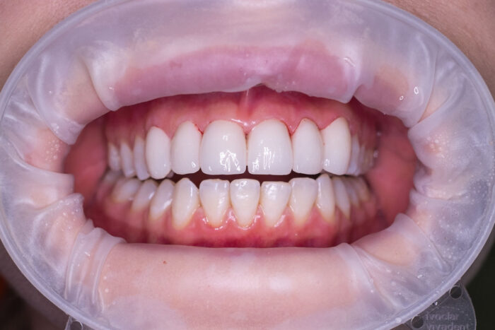 cosmetic dental work in smyrna