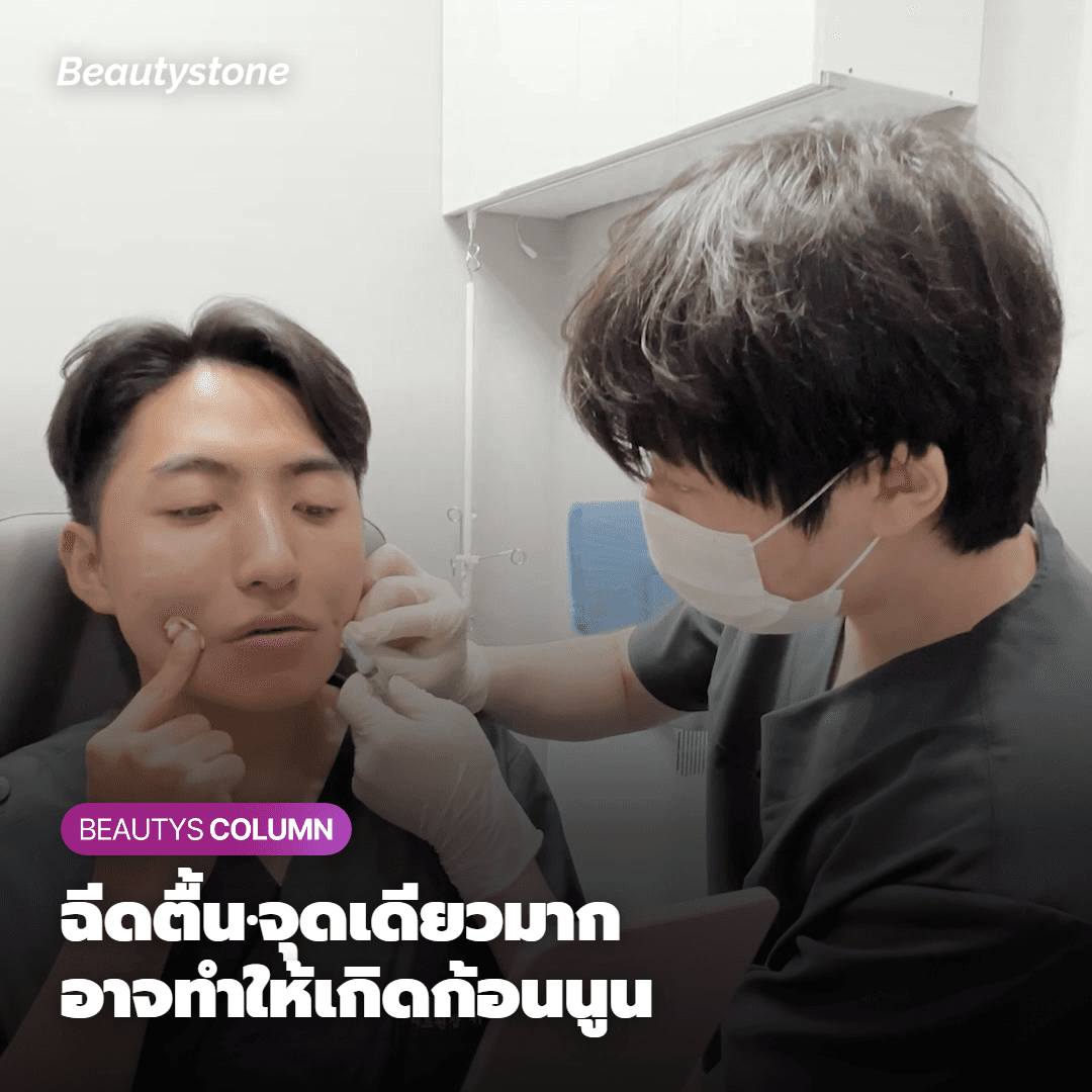 คำถามอันดับ 1 ที่ทักมาถาม เรื่องก้อนนูนจากจูเวลุค ผมขอตอบให้ฟัง