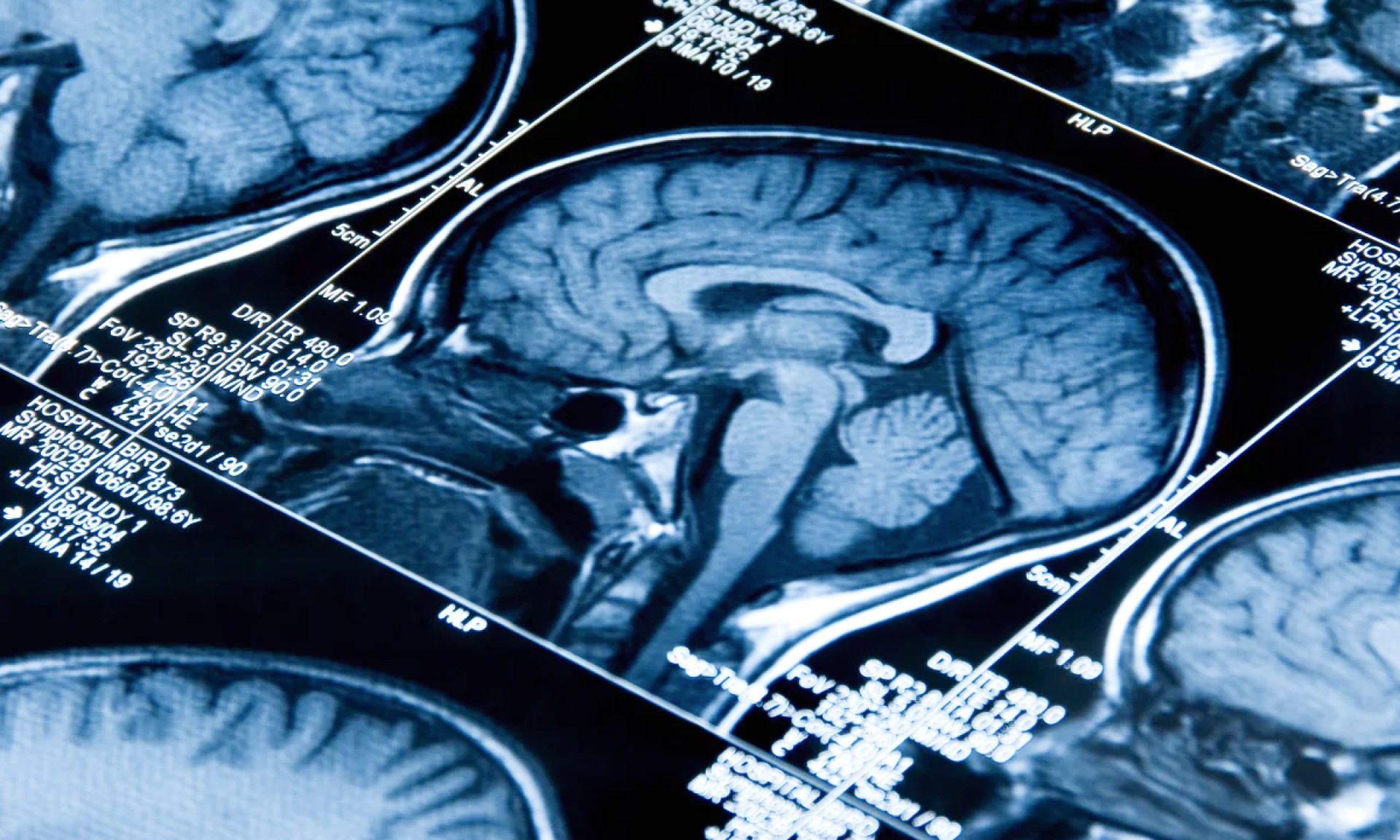 A photo of a brain scan