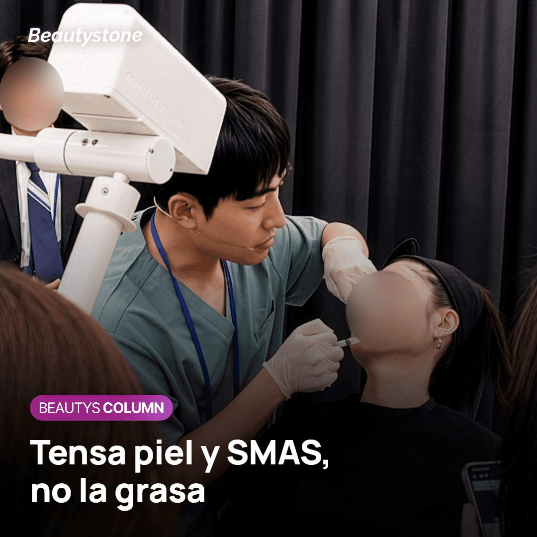 El lifting de mandíbula alcanza la piel y el SMAS, no la grasa ni el hueso hioides