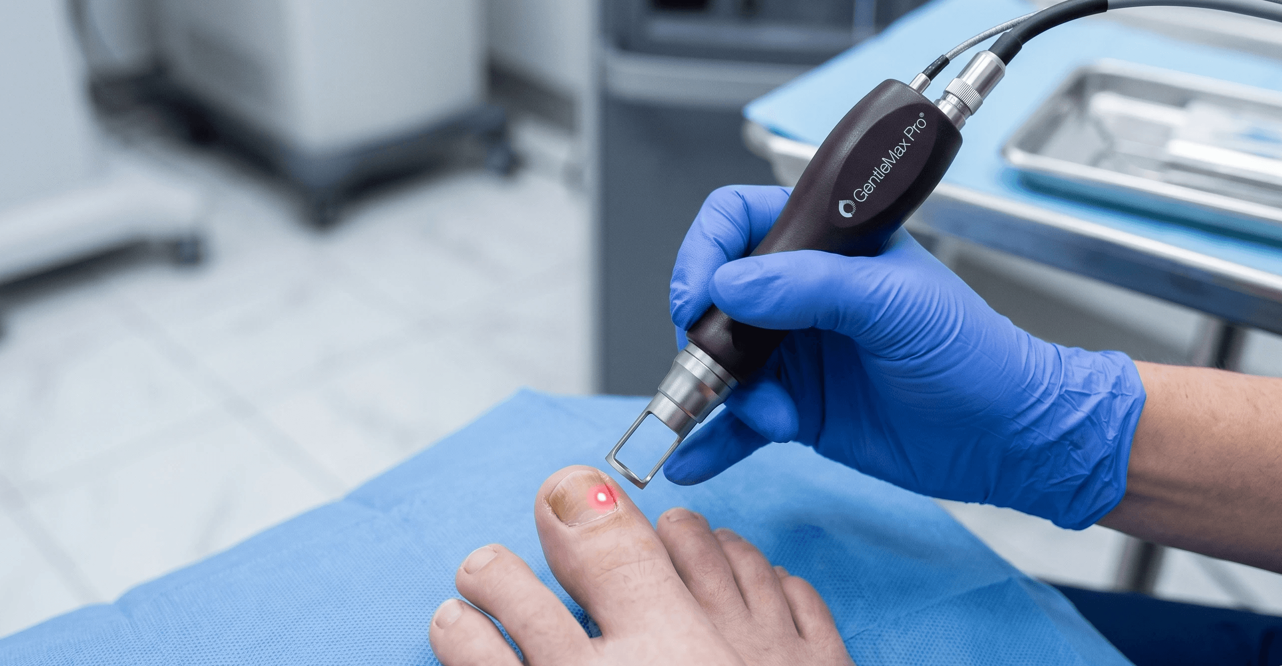A clinical close-up of the Candela GentleMax Pro handpiece being held by a gloved practitioner, aiming the laser at a toenail. The red aiming beam is visible on the nail surface