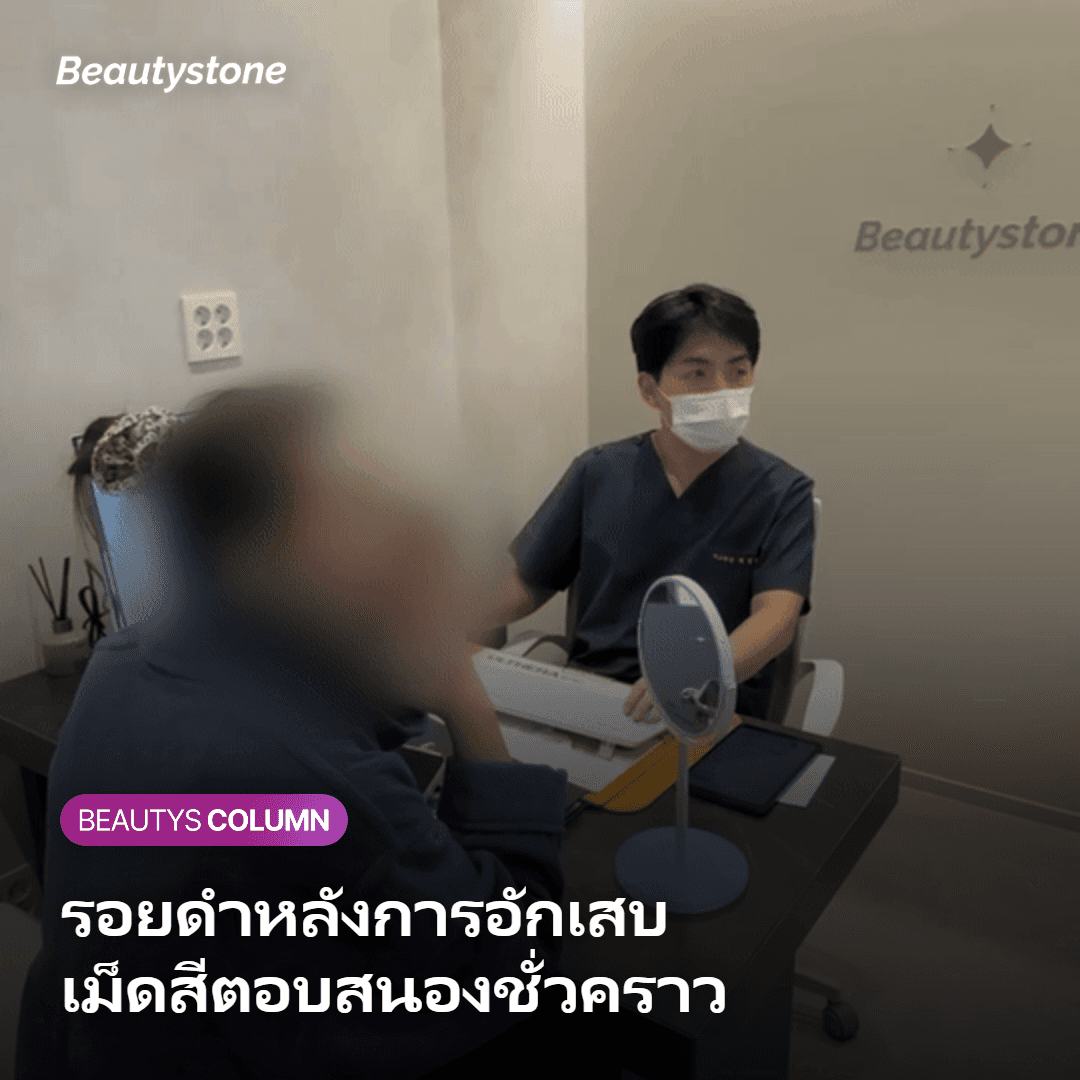 ภาวะรอยดำหลังการอักเสบที่ทำให้ผิวดูเข้มขึ้นชั่วคราวหลังทำเลเซอร์