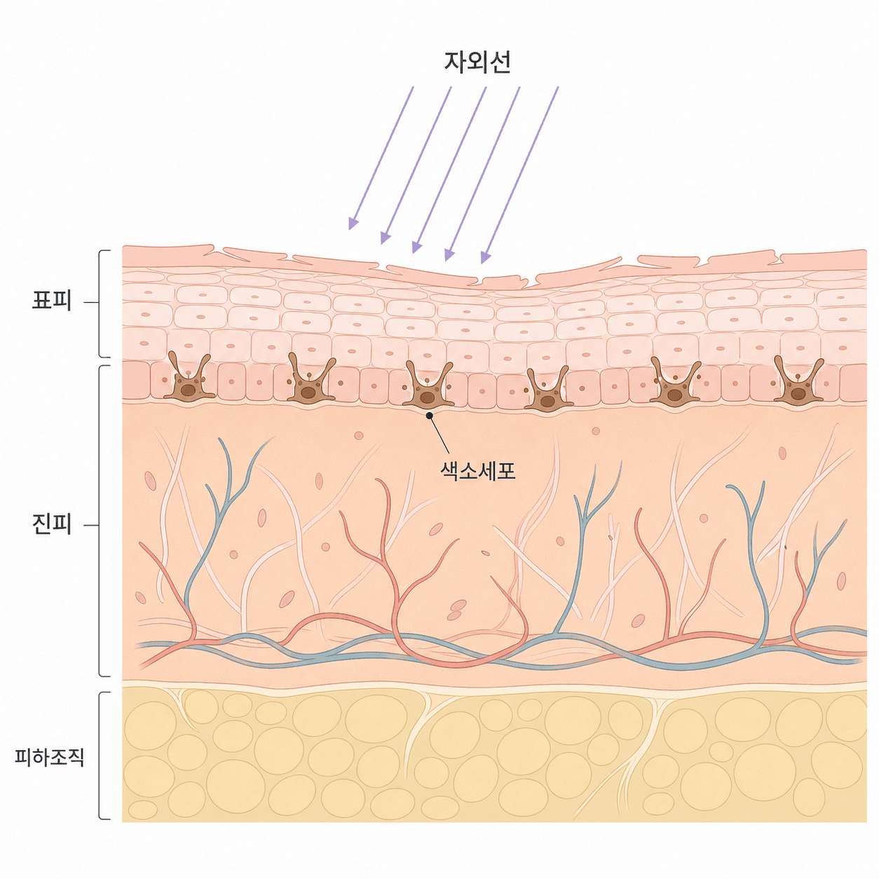 시술 후 잠시 약해진 장벽 위로 자외선이 더해지면 색소세포가 자극받기 쉬워요