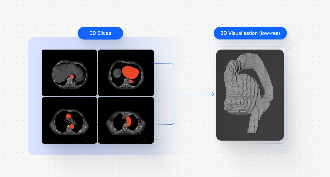 multi-planar medical data