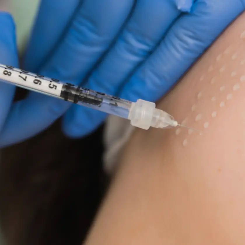 Zbliżenie na skórę podczas mezoterapii igłowej, kosmetolog w rękawiczkach wprowadza preparat cienką igłą