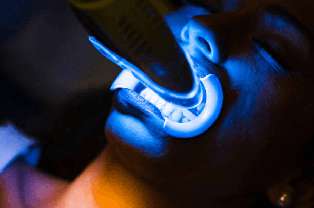 Patient undergoing professional teeth whitening with blue LED light