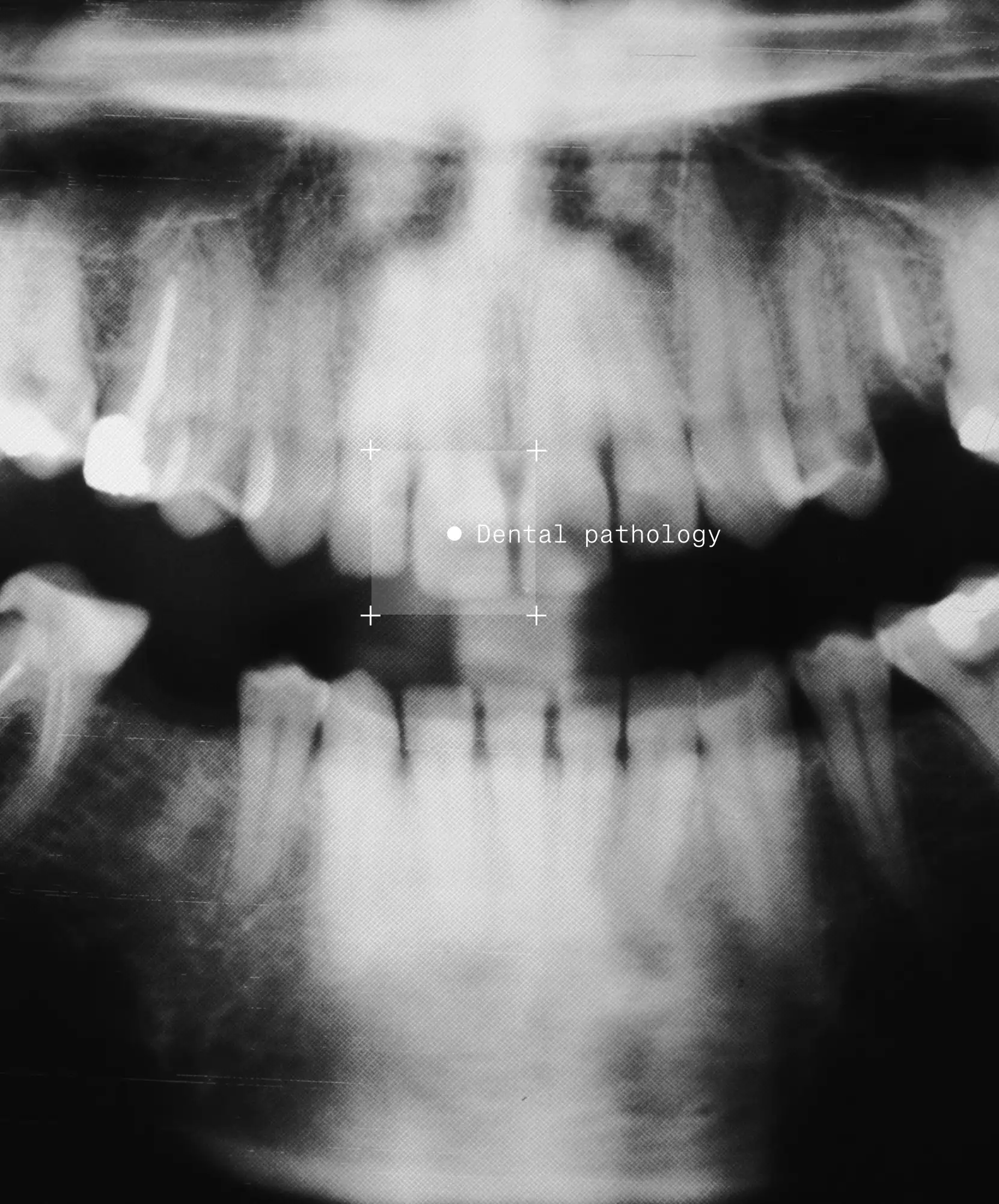 Image of dental X Ray