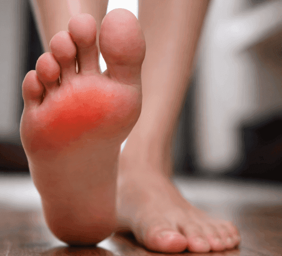 ✔ Gota "Crise de gota no pé com inflamação e vermelhidão"