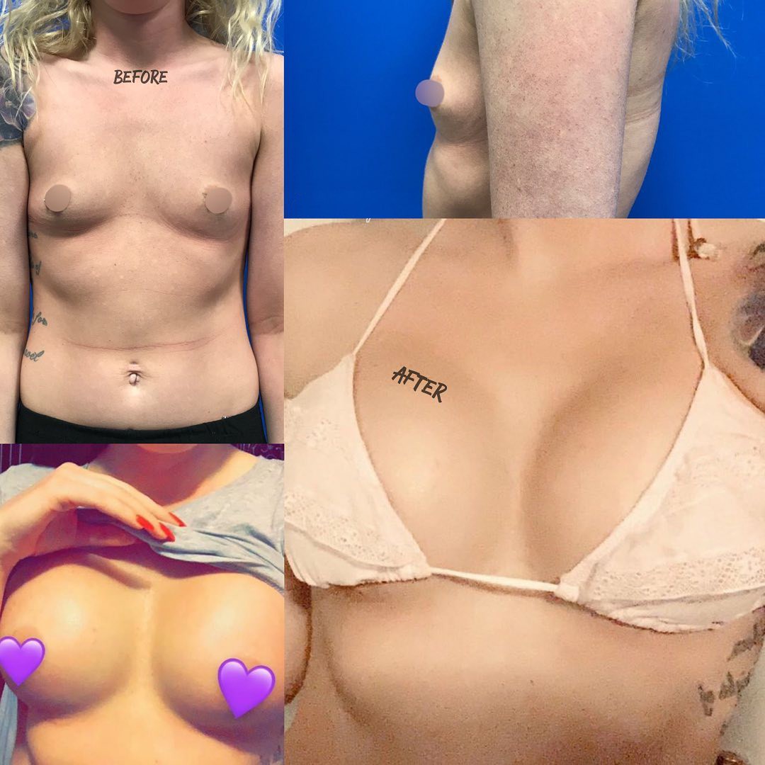 A lone green tree standing in a yellow field with birds flying in the background on a clear day