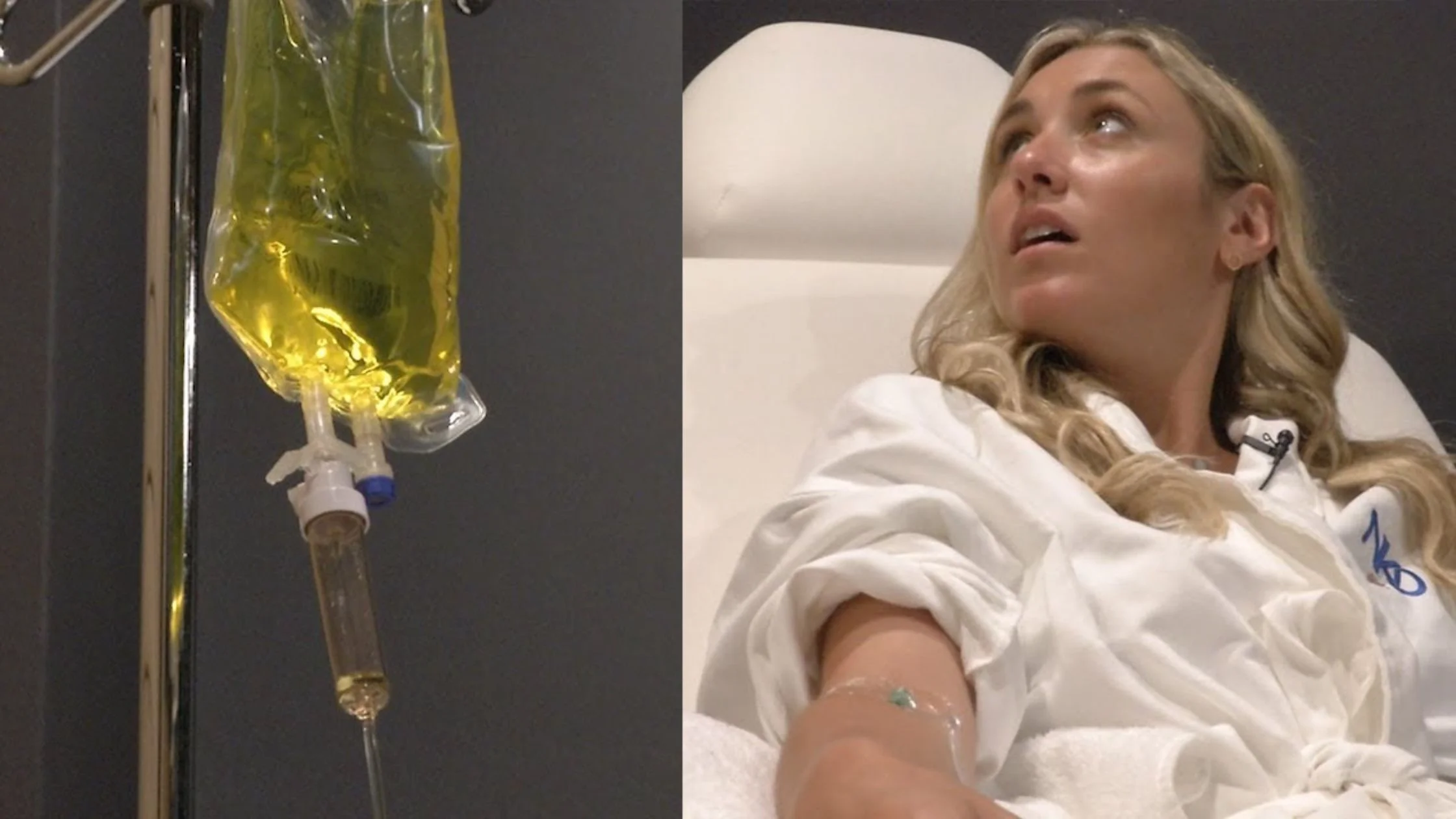 IV Therapy for Hangovers in Frisco