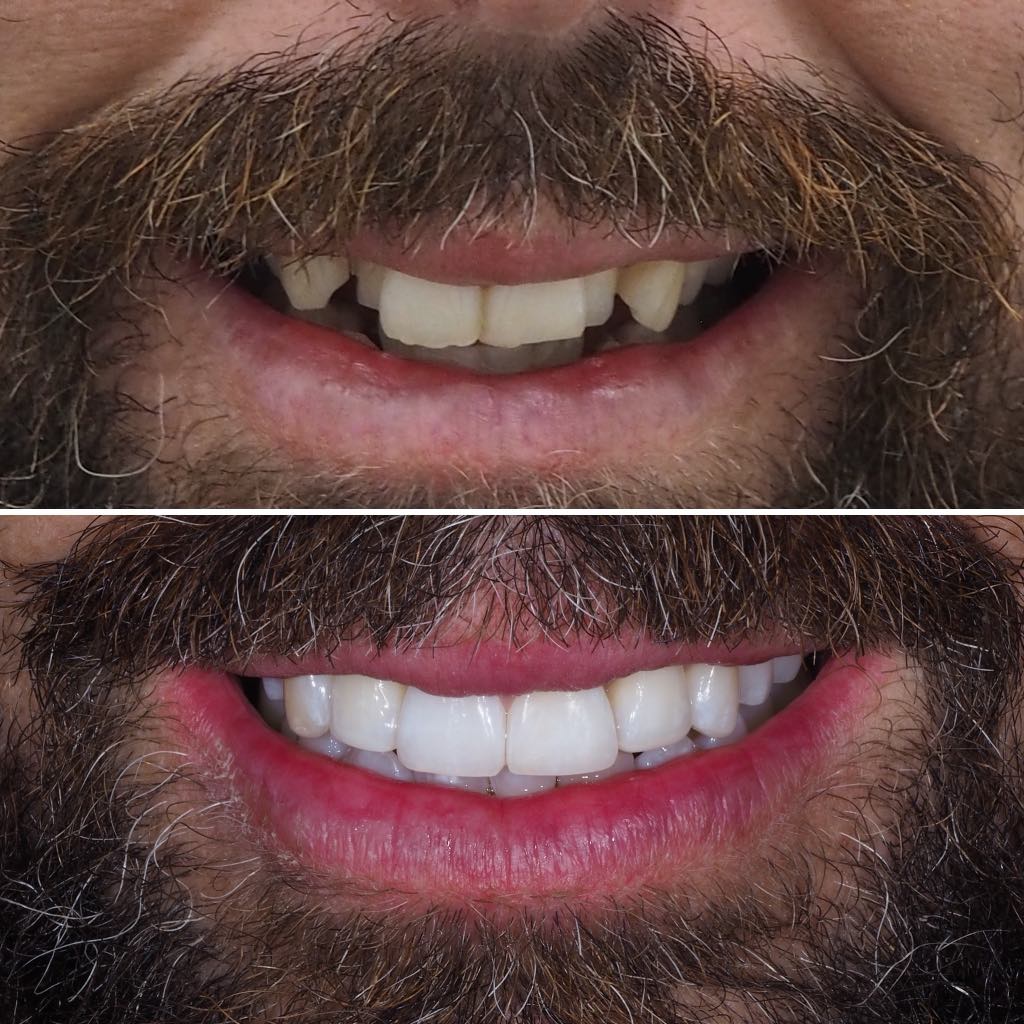 Before & After