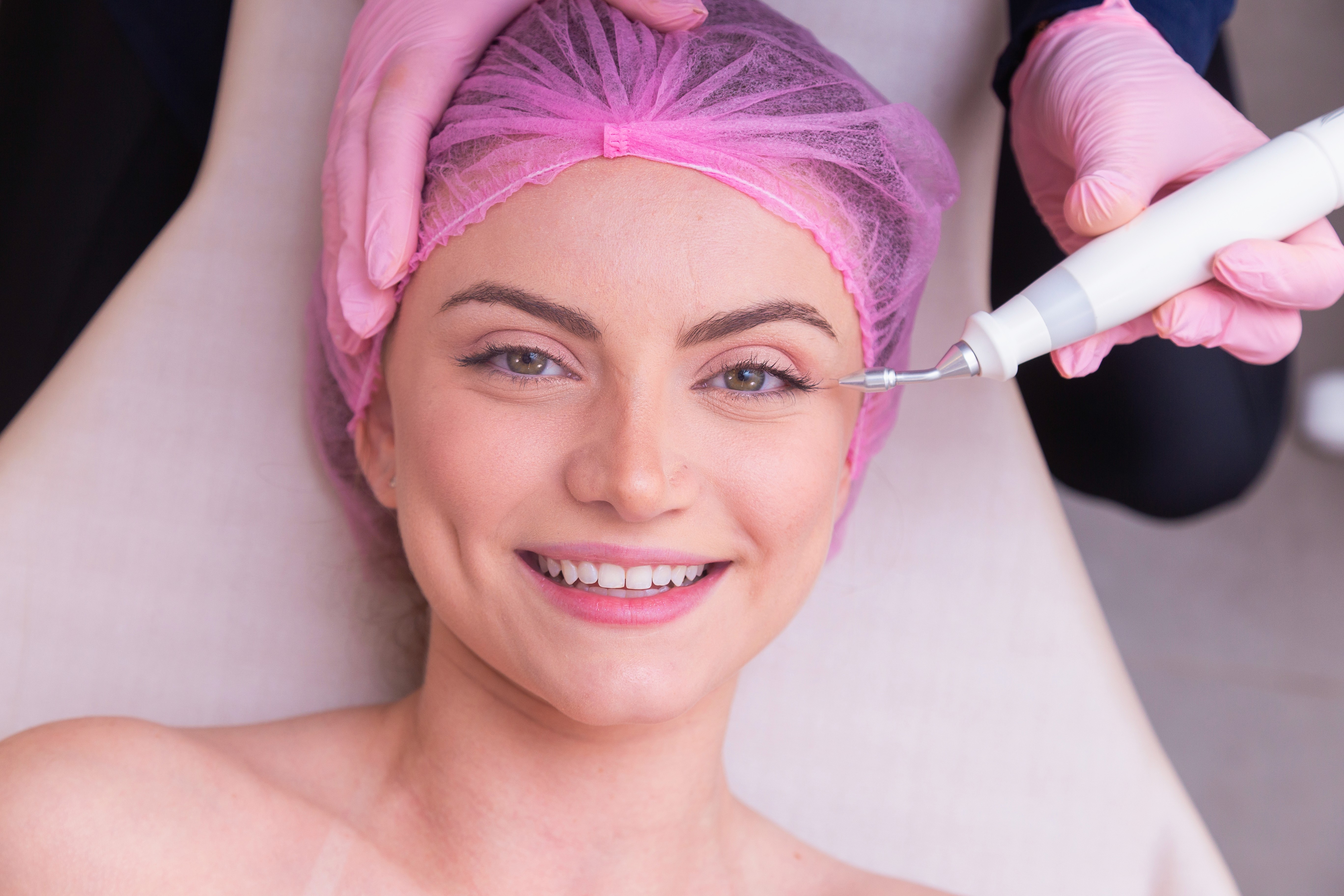 What are the benifit of Microneedling ?