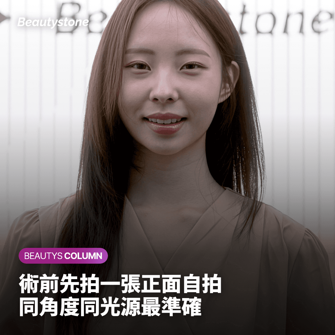 [合井 Beautystone] 30歲·40歲·50歲超聲刀維持時間與重做週期各不相同的原因