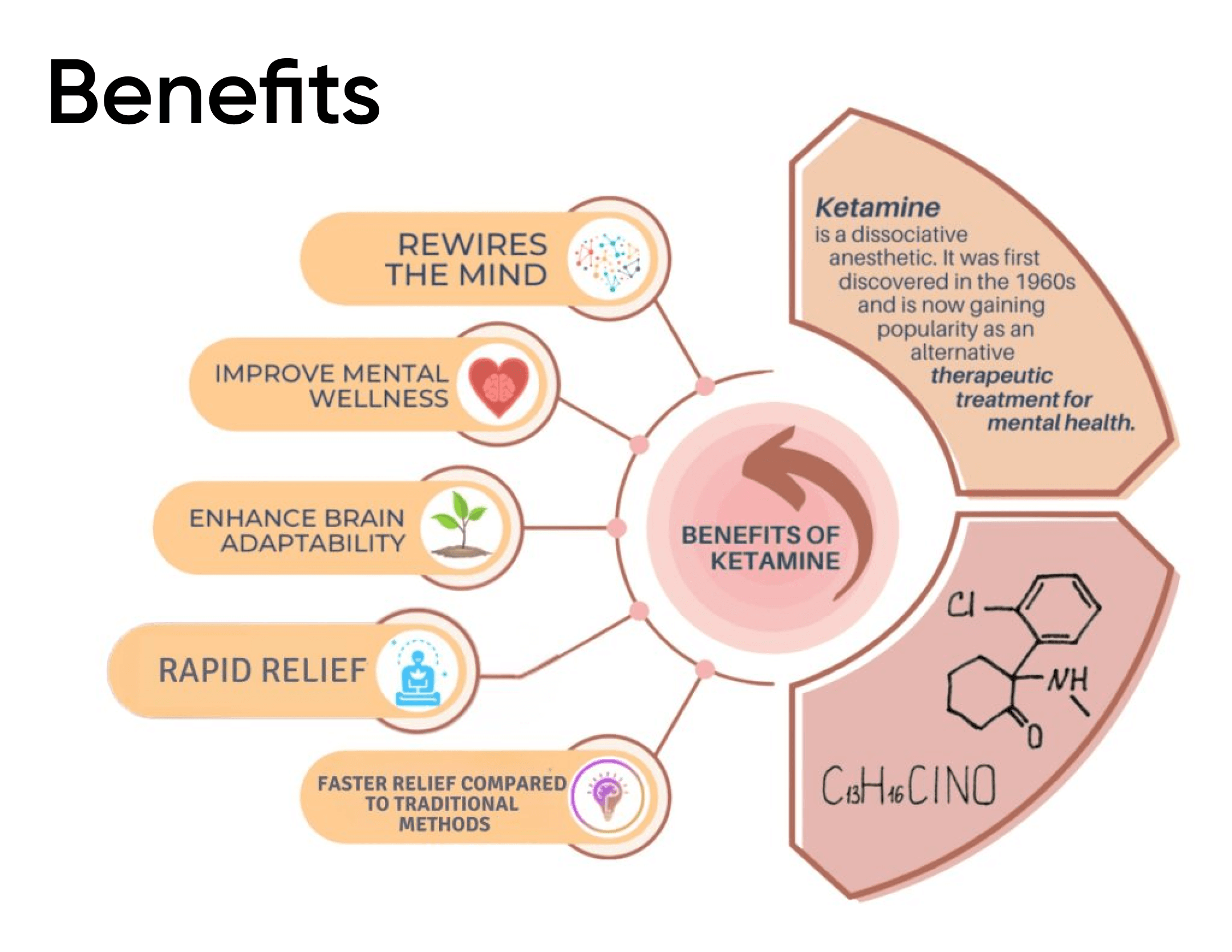 Benefits of Ketamine therapy for mental health, including rapid relief, brain adaptability, and improved wellness.