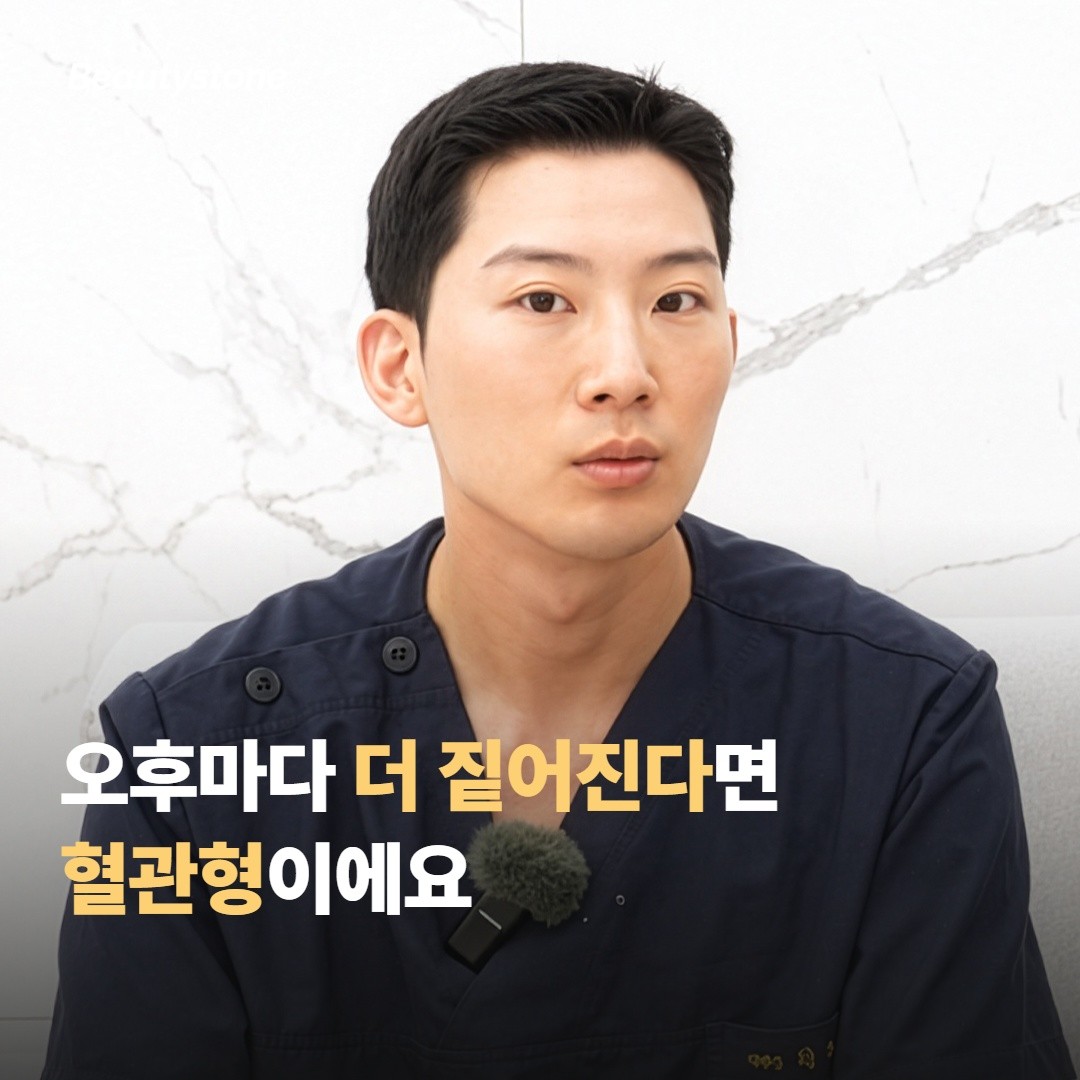 일중 색 변동이 있으면 거의 혈관형이에요