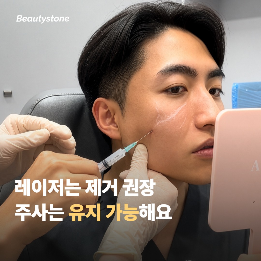 시술 종류별로 갈리는 판단