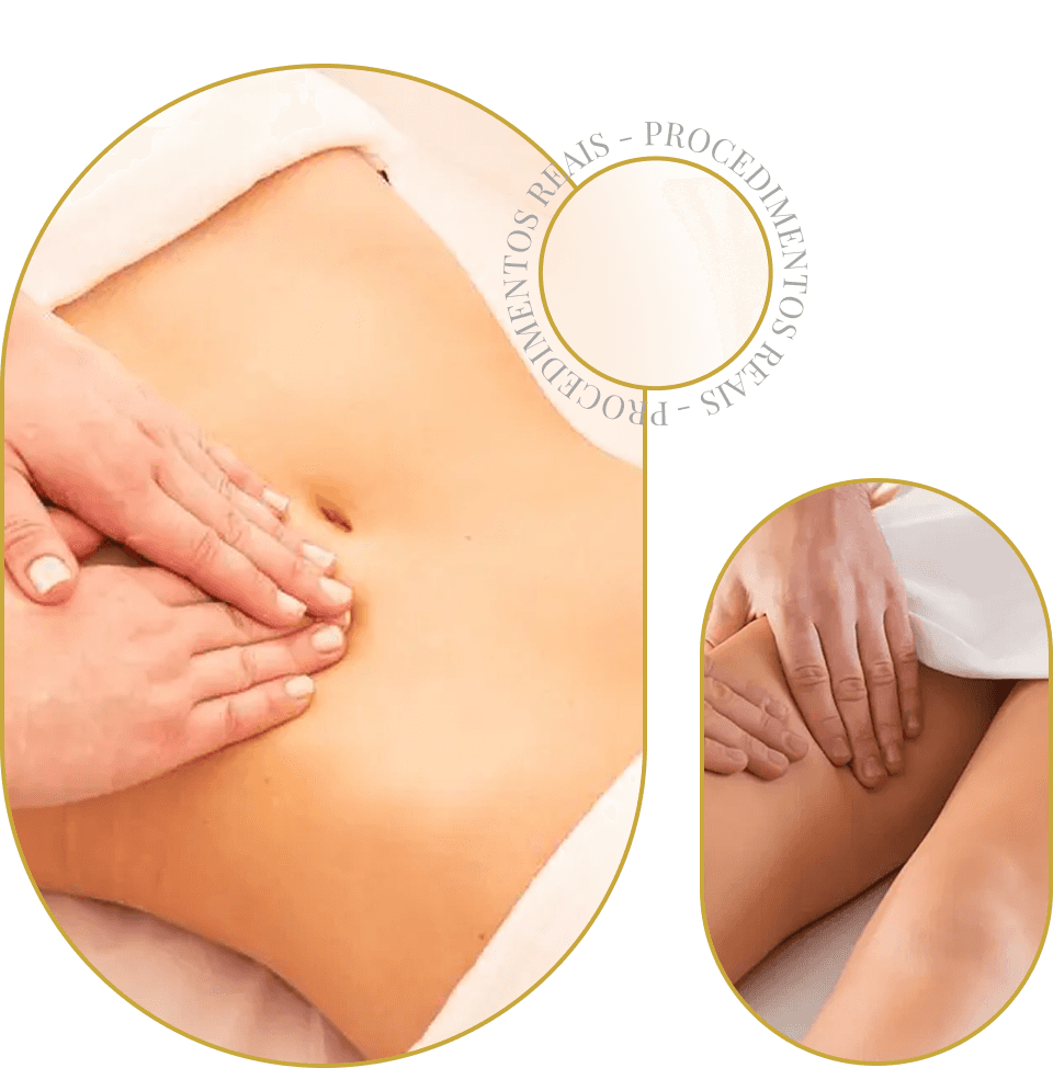 Imagem estética corporal