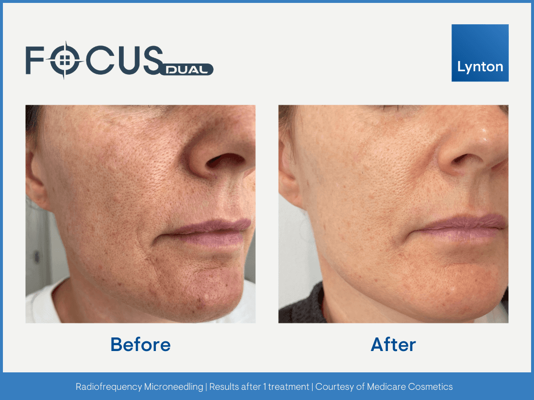 beauty product on a table