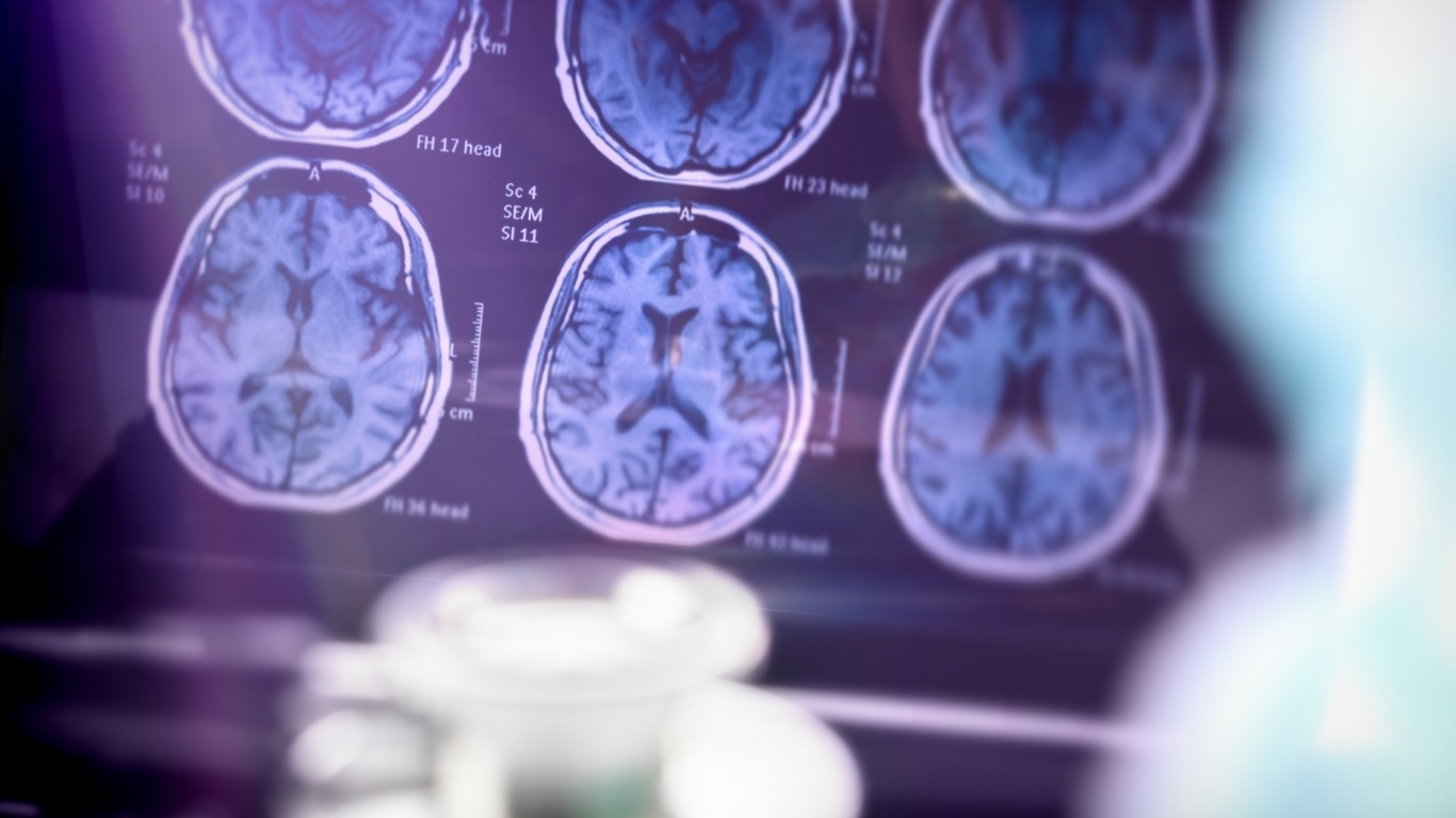 Alzheimer hastalığında kişiselleştirilmiş hassas tıp, bilişsel sağlık ve çok faktörlü tedavi yaklaşımını anlatan görsel