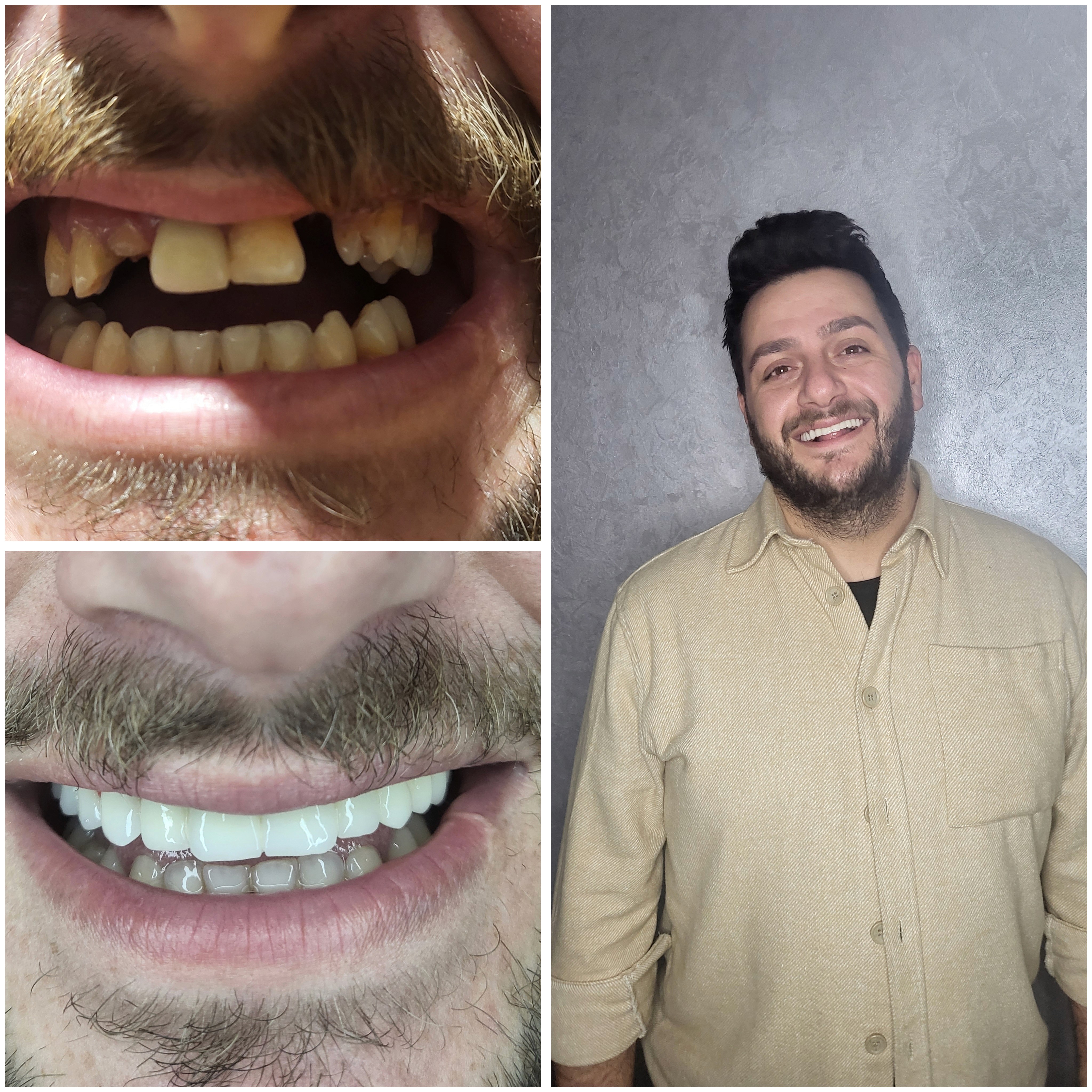 Beautiful woman smiling at the camera with a plain background