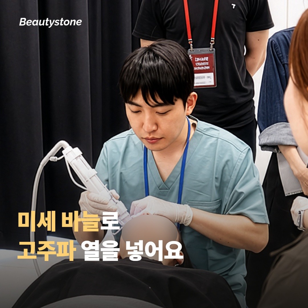 시크릿RF는 어떤 시술인가요?