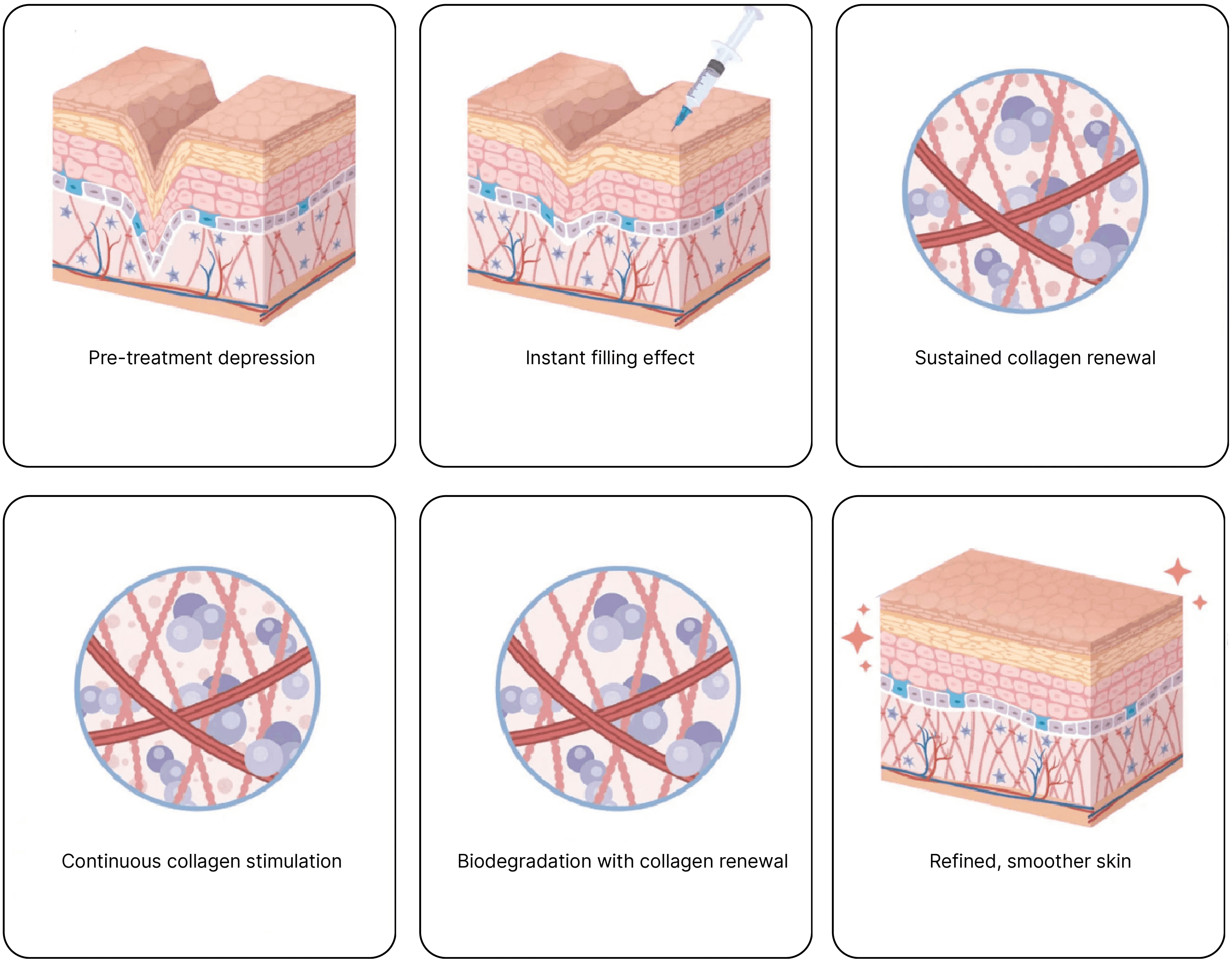 Mechanism of action