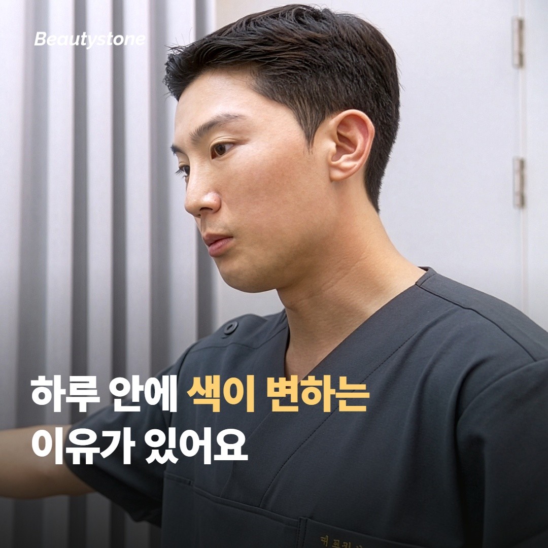 왜 같은 눈밑인데 하루 안에 색이 달라질까요