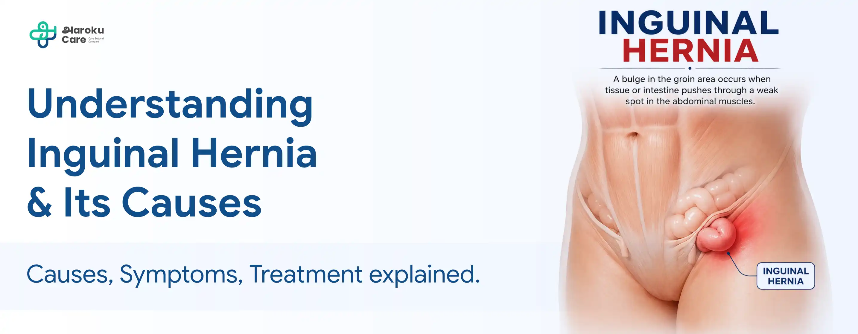 Understanding Anal Abscess & Its Causes