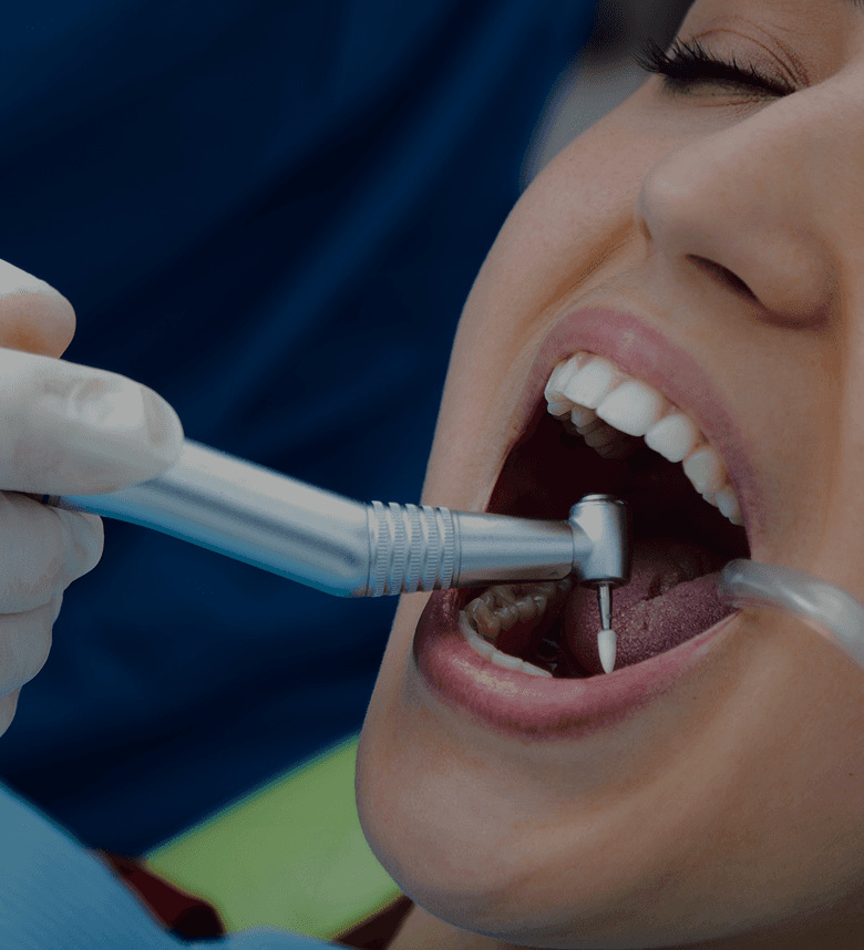 Root Canal Treatment