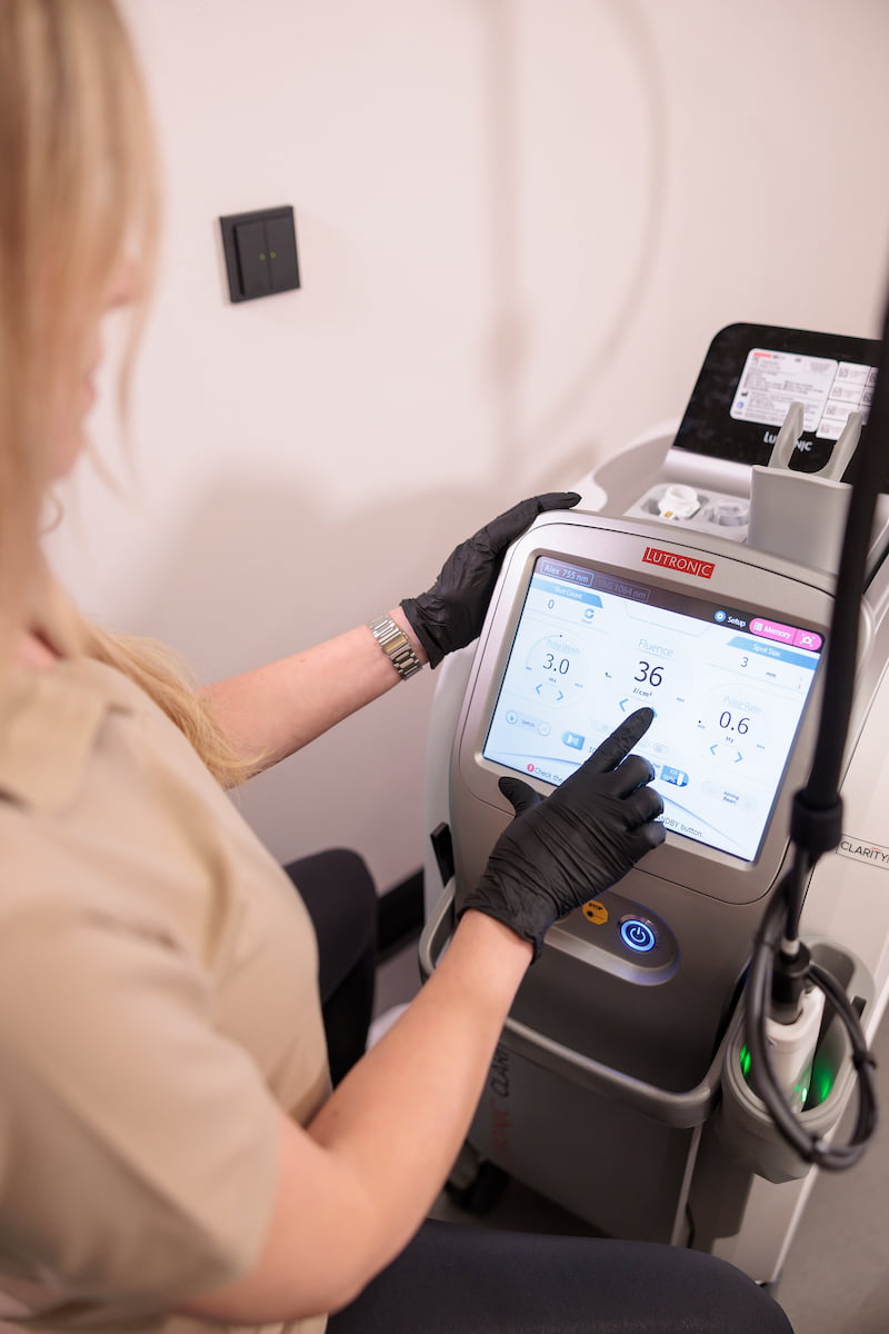 Kosmetikerin bedient Clarity 2 Laser für Haarentfernung - Patientin bei Laserbehandlung am Unterarm - SkinCare Halle