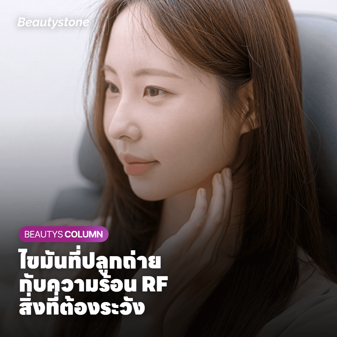 ภาพอธิบายกระบวนการฝังตัวของไขมันที่ปลูกถ่ายและผลของความร้อน RF