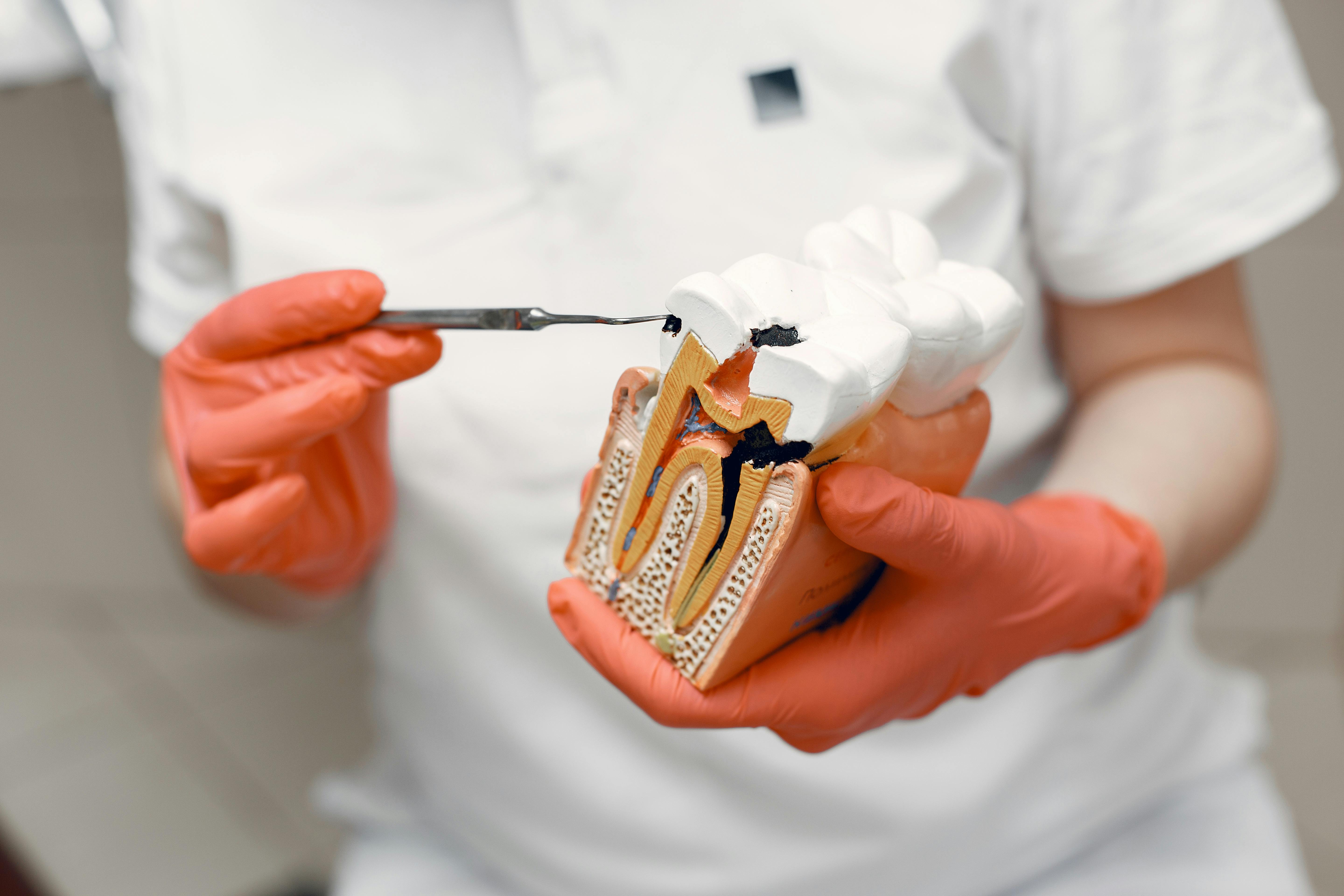 Root canal