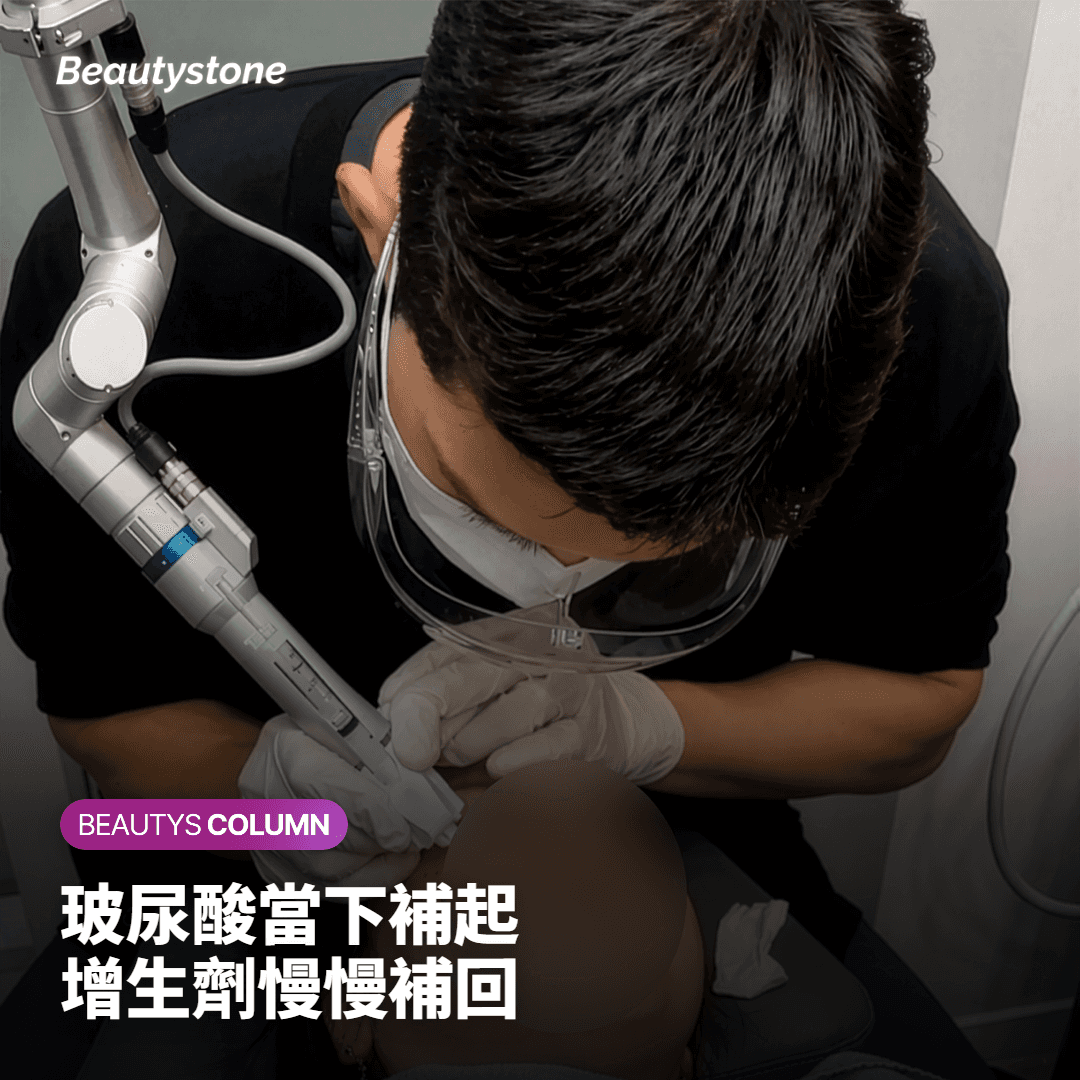 臉頰凹陷打玻尿酸還是童顏針？當下補起與慢慢補回的差別