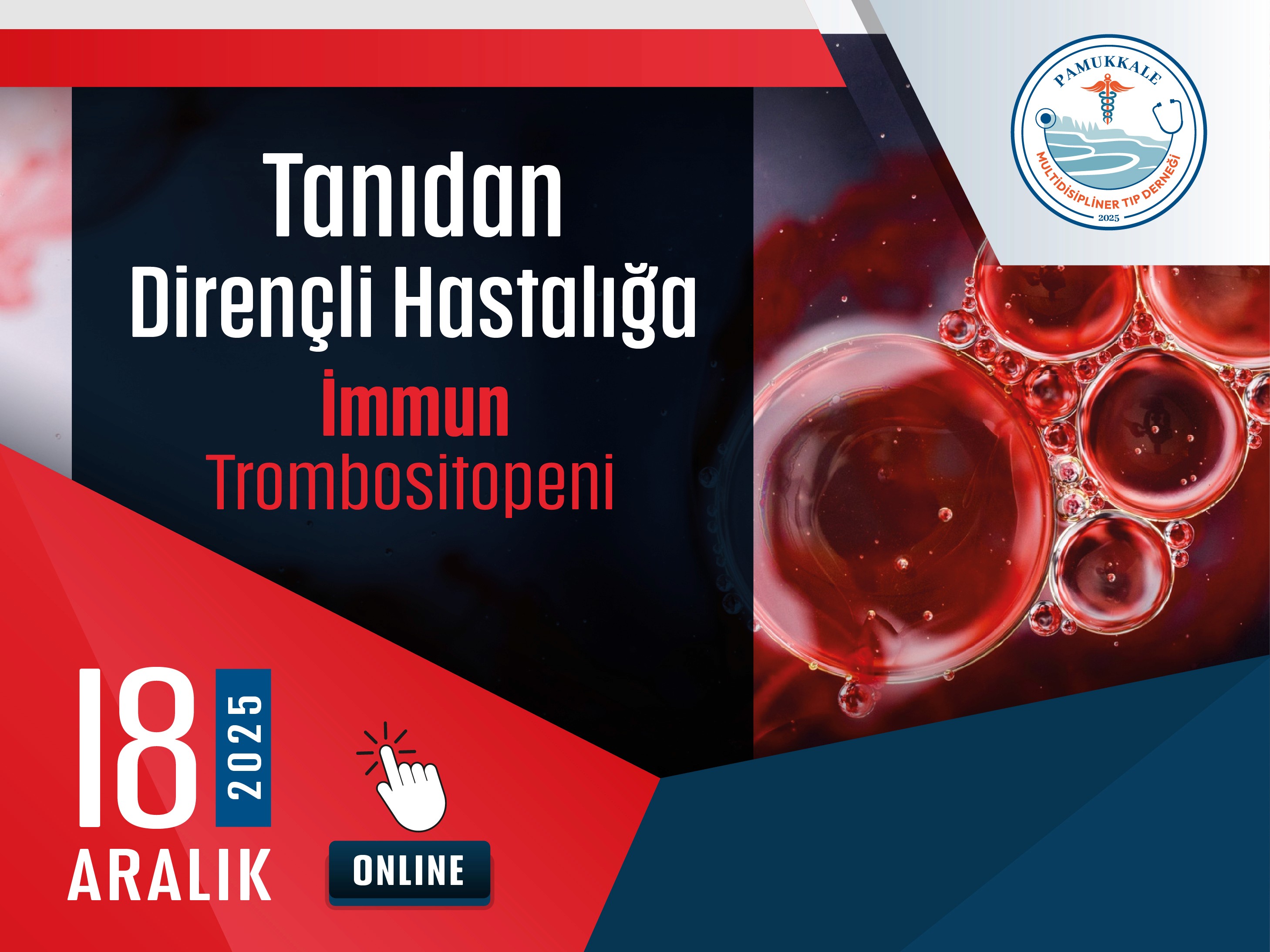tanidan-direncli-hastaliga-immun-trombositopeni