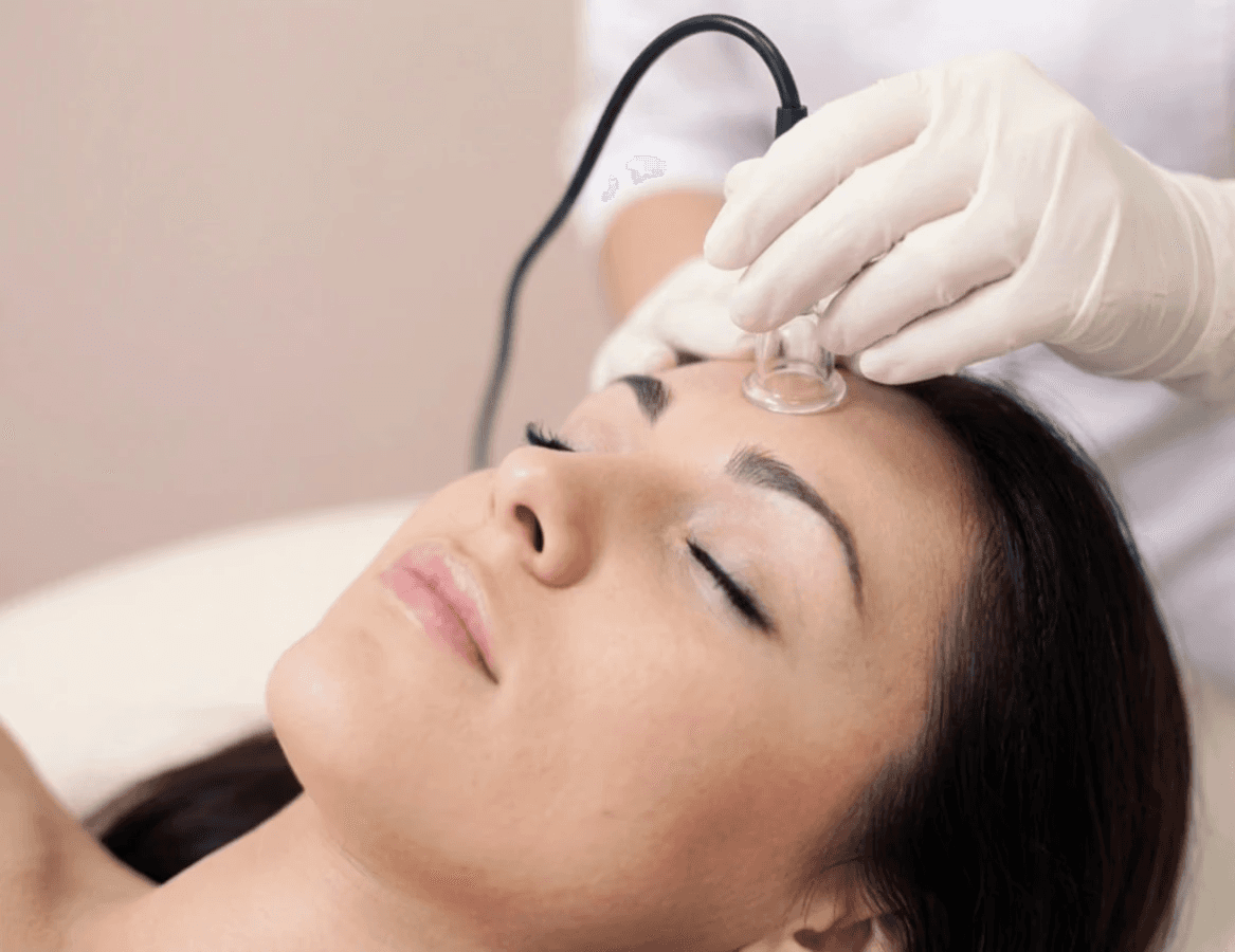 Sejas vakuummasāžas procedūra limfas atteces stimulēšanai