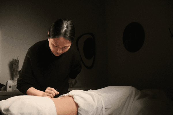 Acupuncturist inserting a needle on a patient's belly